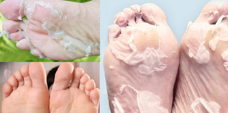 215832335919FCB11CB55F