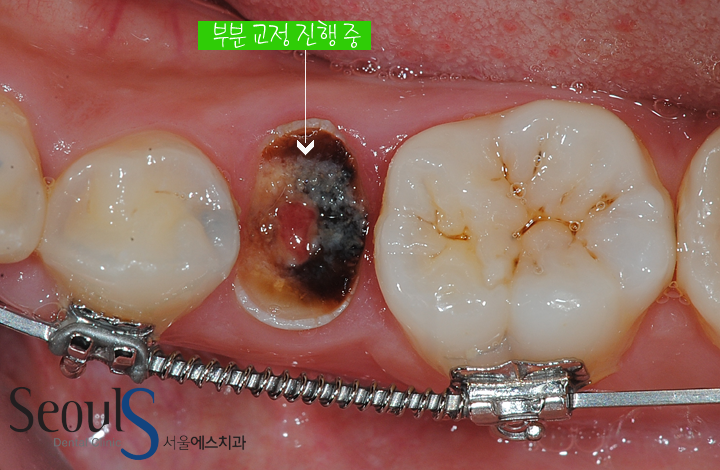 더블클릭을 하시면 이미지를 수정할 수 있습니다