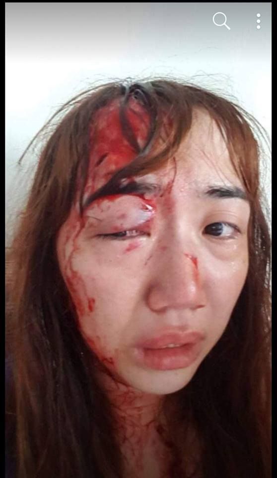 [펌] 한국남편이 필 부인을 골프체로 때렸네요...